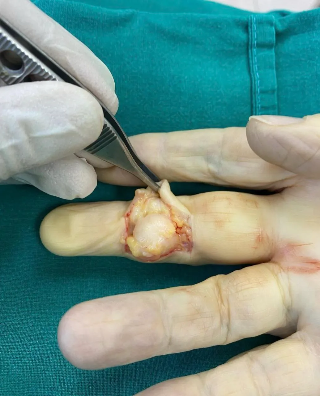 Хирургическое лечение заболеваний кисти